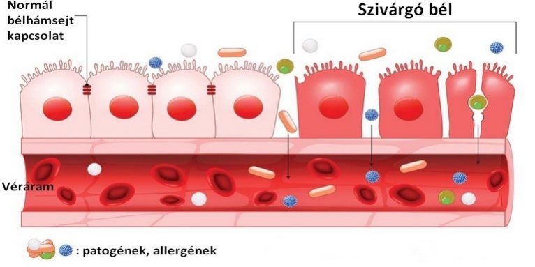 szivárgó_bél szivárgó bél